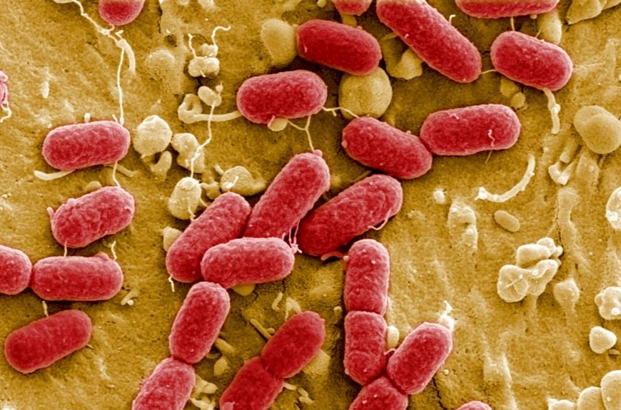 Bacterias al microscopio
