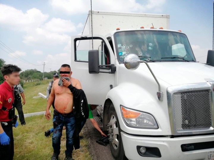 Conductor lesionado tras asalto