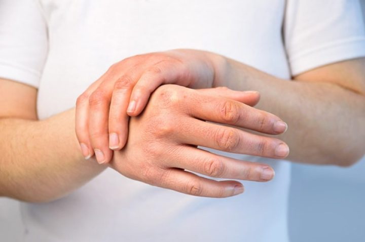  Esclerodermia